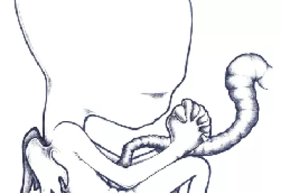 Sigur Rós comemora 10 anos de Agaetis Byrjun
