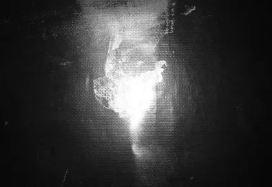 Exploding Head Syndrome